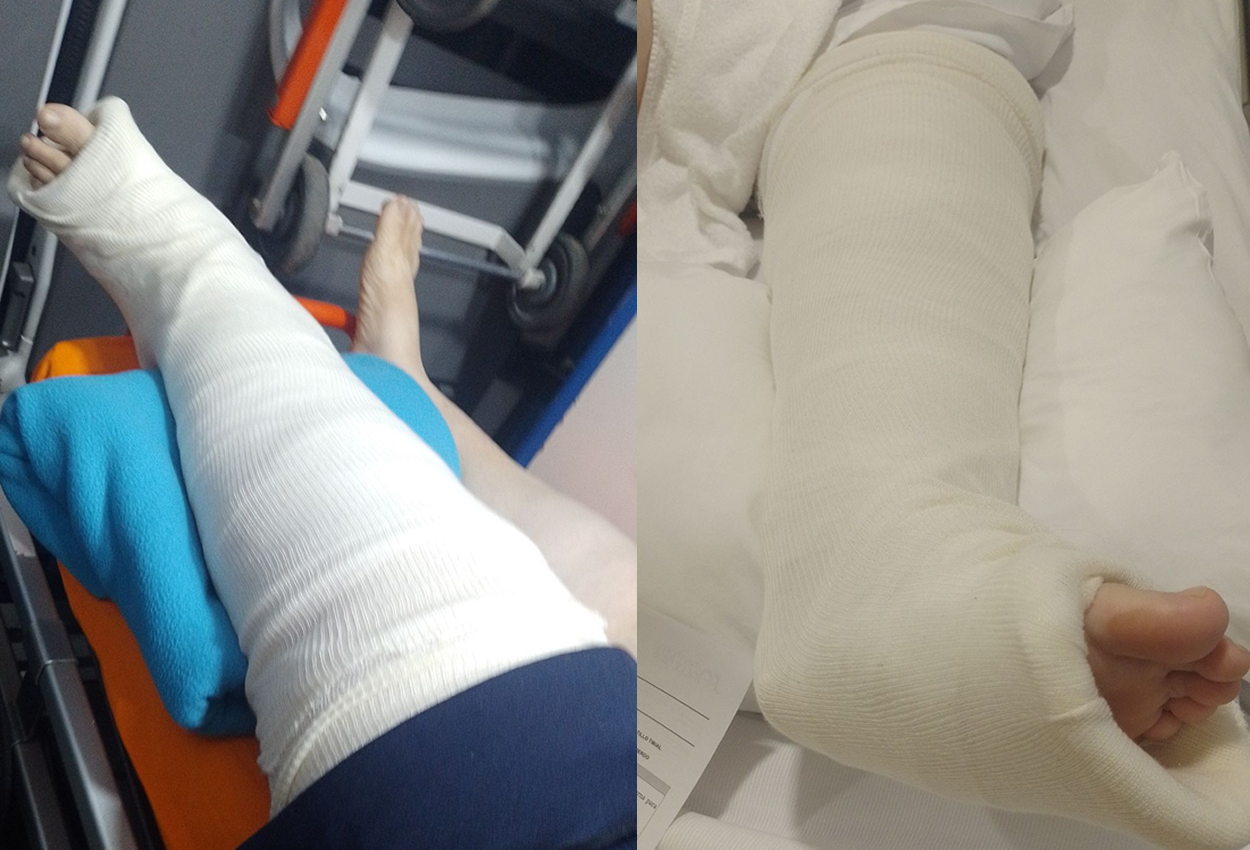 Morteros: Otro grave accidente por un perro suelto