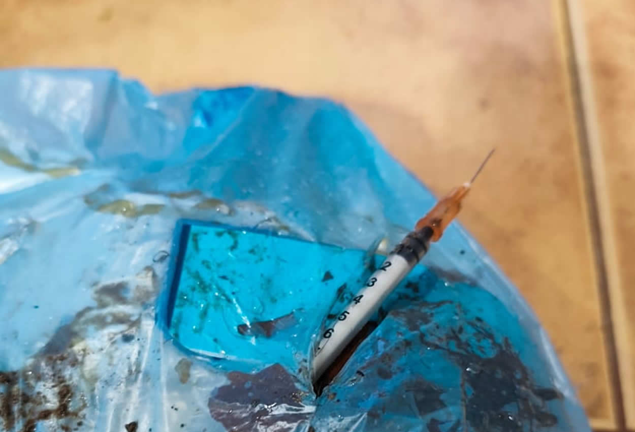 Morteros: Grave incidente con una jeringa mal descartada pone en riesgo la salud de un recolector municipal